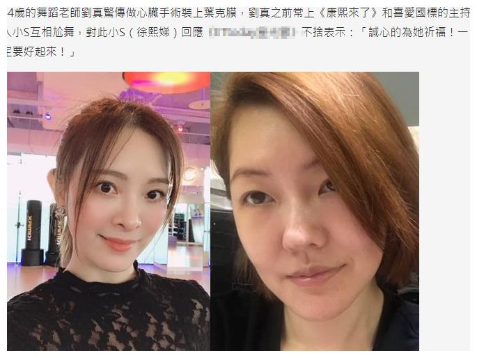 国际舞女王刘真被曝病危装上叶克膜正在抢救？小S回应：为她祈福