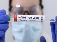猴痘病毒出现首例人传狗 猴痘病毒中国首例 猴痘病毒感染病例