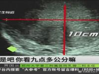 15岁女孩不对称查出10cm肿瘤   乳腺肿瘤10mmX13mm 肿瘤11公分大不大