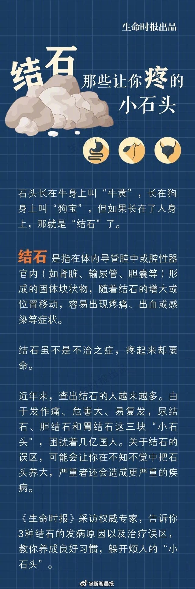 男子排尿疼痛取出鹅蛋大的结石 男性结石 男子结石到达尿道口不出怎么办