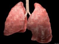 新冠白肺意味着什么 白肺真的不能治吗