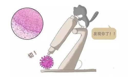 hpv18阳性就是出轨了