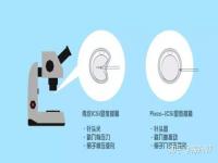 试管养囊和不养囊的区别,艰辛的试管之路