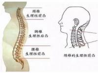 颈椎痛怎么缓解,如何缓解颈椎痛？