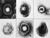 水痘是单纯疱疹病毒吗,什么是水痘？水痘留下的痘坑是不是没救了？
