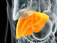 脂肪肝一般几年肝硬化,脂肪肝一般几年肝硬化，早了解，早重视