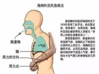 海姆立克的正确手法,如何正确使用海姆立克急救法？