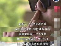 男子整形后称没法靠颜值吃饭了,晨意帮忙丨整形后鼻子流脓留疤，小伙：我没法靠颜值吃饭了