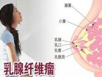 乳腺肿瘤的五个分级_乳腺肿瘤的症状10大前兆