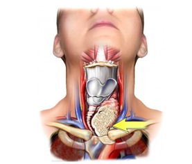 甲状腺癌常见的四个信号_肿瘤医生：甲状腺癌有4个常见信号