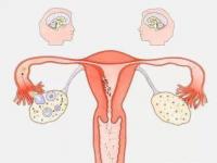 7大因素导致卵巢早衰_什么引起的卵巢早衰？无外乎这7个原因！做好2点，延缓卵巢早衰