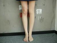 女子长期穿光腿神器导致迈不开腿_女子长时间穿光腿神器导致迈不开腿