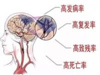 怎样尽早识别脑血管疾病_如何早期识别心脑血管病症状