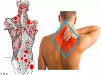肩颈痛大多是斜方肌出问题_为什么10个肩颈痛患者，9个是“斜方肌”出问题？