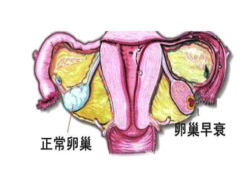 卵巢早衰会有哪些危害_可怕的卵巢早衰，这5个危害或随之而来，早发现早治疗是关键