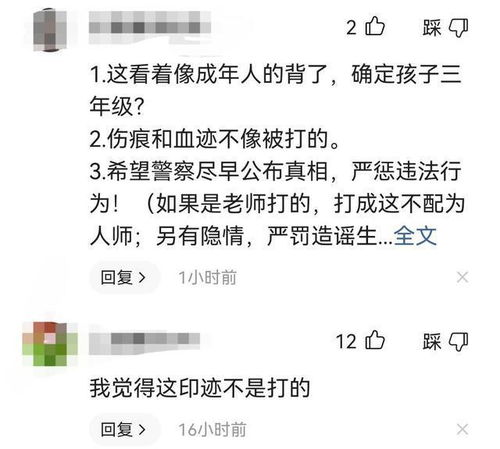 教育局回应小学生被老师打到头部变形_虐待式教育，一名小学生被老师打到头部变形！！