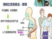 男生突然卡喉女生海姆立克6秒急救_女孩“海姆立克”急救异物卡喉男生，学会这个急救法很重要。