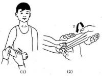 肩关节脱位复位方法_胳膊脱臼后如何保养