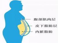 内脏脂肪高怎么办_内脏脂肪7级什么意思