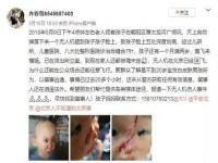 父亲无证驾驶撞人，儿子是否有连带责任赔偿_70岁老人无力赔偿交强险