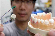 谷歌诡异专利：智能牙齿