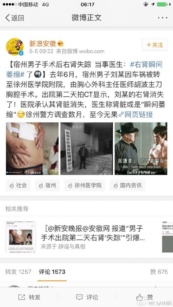 男子手术后右肾失踪？！真相在此！附医院声明CT