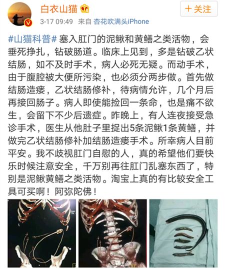 黄鳝女主播是谁是什么梗 黄鳝琪琪因不雅视频被封