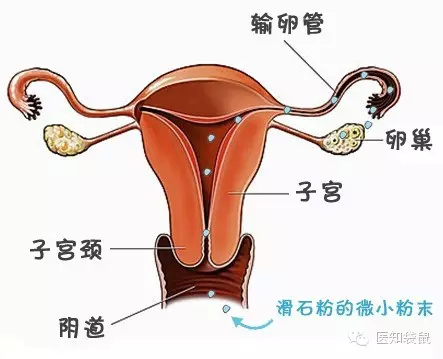 强生婴儿爽身粉致癌是真的吗?强生爽身粉对宝宝有害吗?还能用吗?