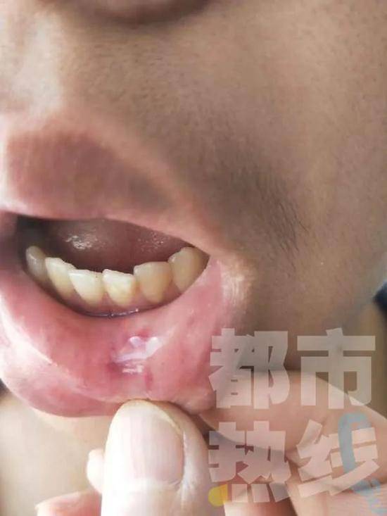 延安一女教师掌掴初二男生被停职，校方已登门道歉