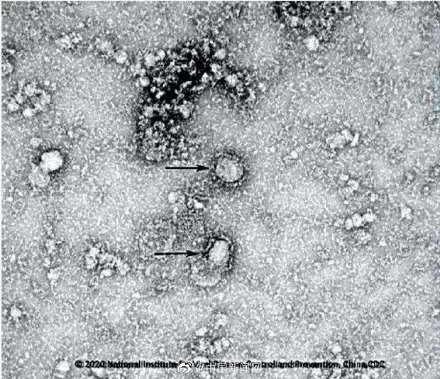 新研究发现冠状病毒致命弱点 冠状病毒致命弱点是什么?