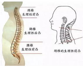 颈椎痛怎么缓解