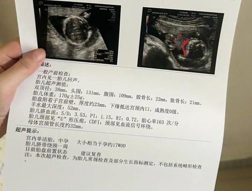 00后代孕流产女孩发声_00后代孕流产女孩发声，昆山成立调查组，女孩已安排照顾