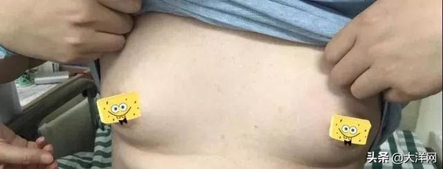 25岁小伙胸部越来越大，按一下乳汁飚出半米远