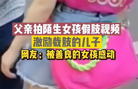 大叔街上拦住两名少女，要求拍摄假肢的视频，原因令人动容！