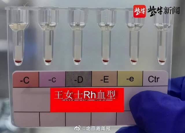 江苏发现2例全球罕见黄型  黄型全球不足50例可以给所有人输血