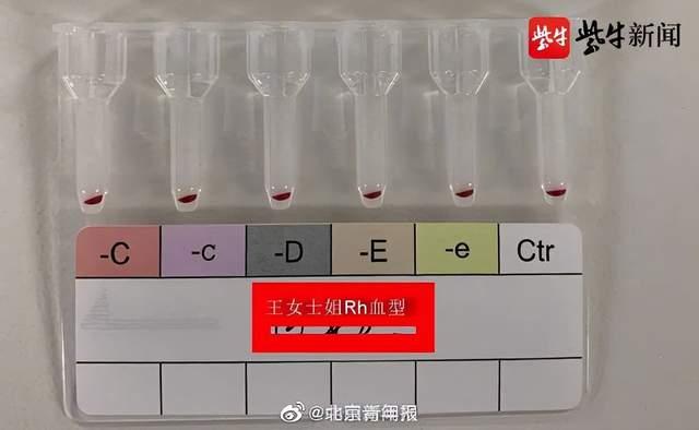 江苏发现2例全球罕见黄型  黄型全球不足50例可以给所有人输血