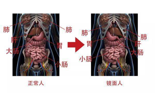 女子五脏六腑全部反着长 南宁一女子的五脏六腑全部反着长是怎么回事