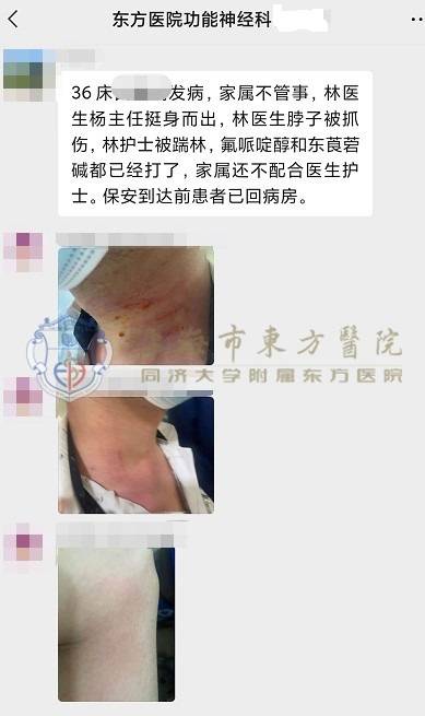 阳性前兆有什么症状