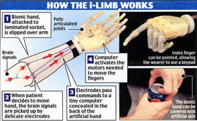 残疾人能靠意识控制仿生手丝滑弹琴_残疾人用上“智能仿生手”可实现抓、握、捏等20多种动作
