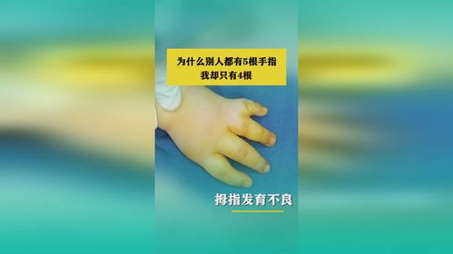 你们有5根手指 我只有4根诶_人类为何长5根手指头，不是4根也不是6根，科学家告诉你答案！