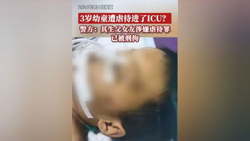 3岁幼童遭虐待进ICU生父女友被刑拘_三岁半男童被父亲女友虐待进ICU？警方：涉事女子已被刑拘