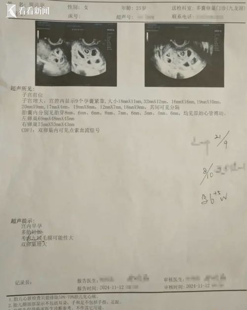 怀9胞胎女子将减去7个胚胎_怀9胞胎女子将减去7个胚胎 分两次进行