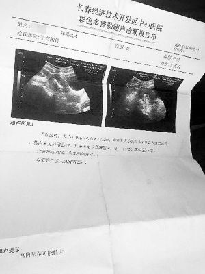 医院通报女子做彩超时陌生男闯入_女子裸露上身做检查时，陌生男子突然闯入！医院通报