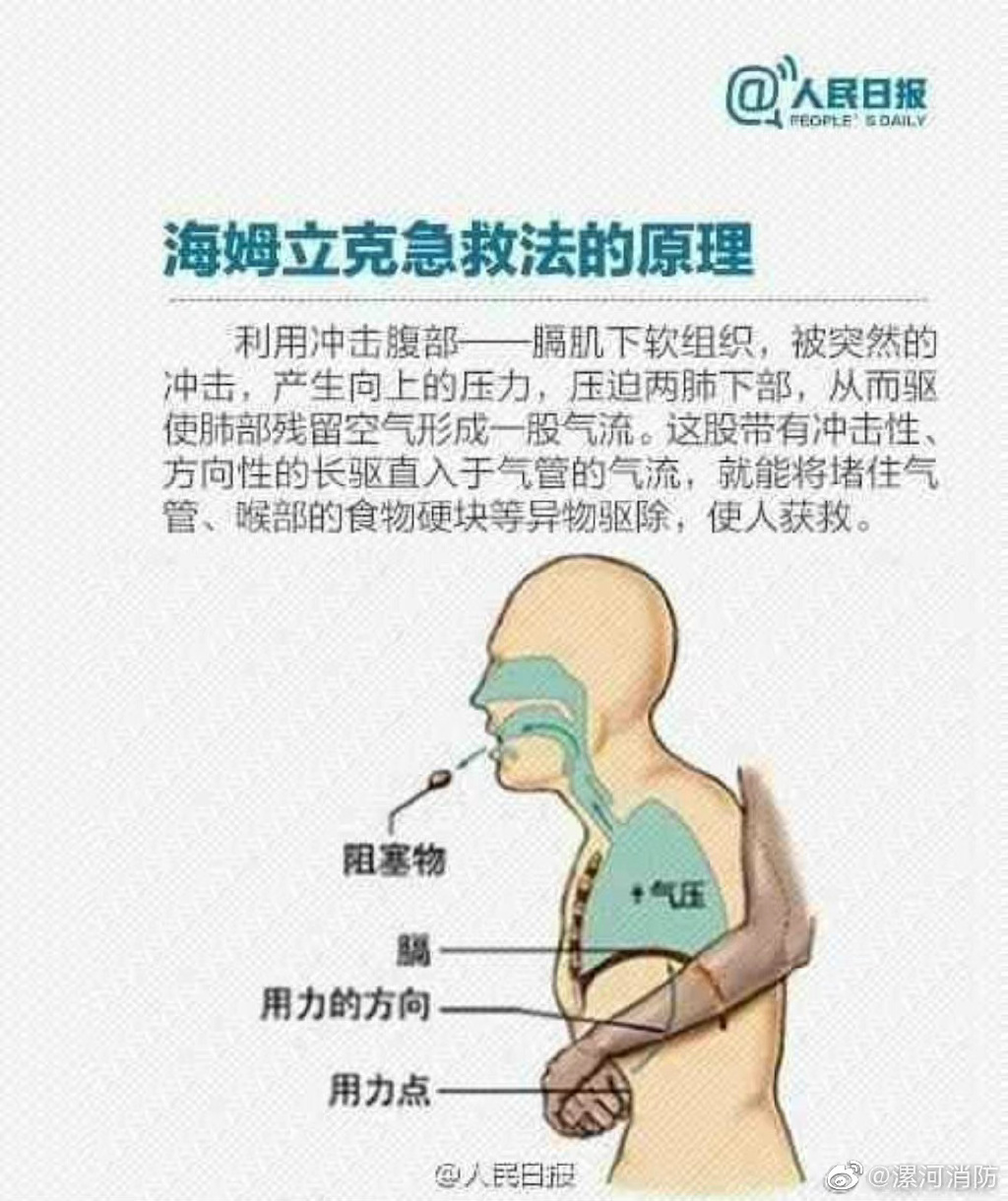 男子被啤酒瓶盖卡喉用馒头咽下,误吞啤酒瓶盖