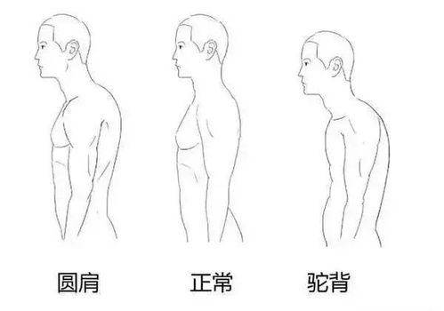 圆肩驼背可能会导致龅牙_判断孩子口呼吸的方法有哪些？