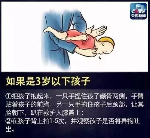 护士用海姆立克和心肺复苏救下婴儿_护士用海姆立克法60秒救回男童 这种方法到底怎样操作？