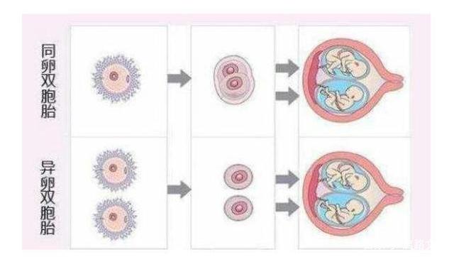 男婴腹中藏寄生胎是什么情况?寄生胎是什么寄生胎胎中胎揭秘