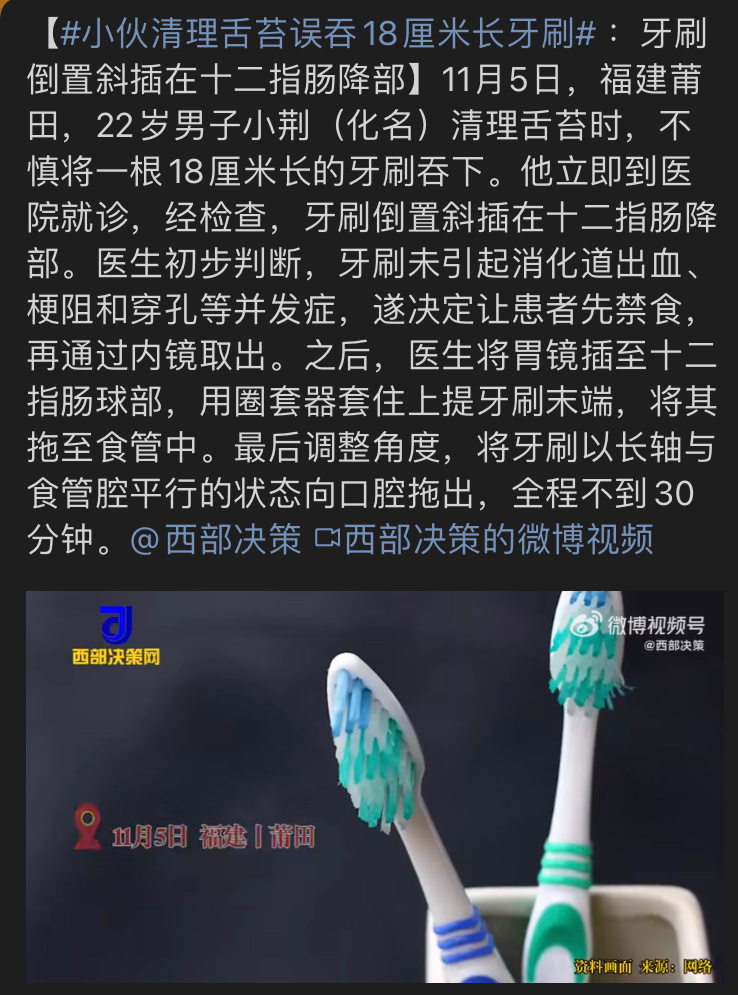 小伙清理舌苔误吞18厘米长牙刷 舌苔需要刮吗 舌苔刮掉口臭就没了