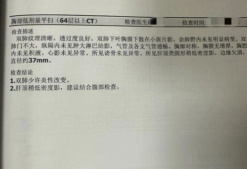 体检报告中这些字眼可能是癌_检报告中这些字眼可能是癌！肿瘤医生：这些癌症的“蛛丝马迹”别忽视！