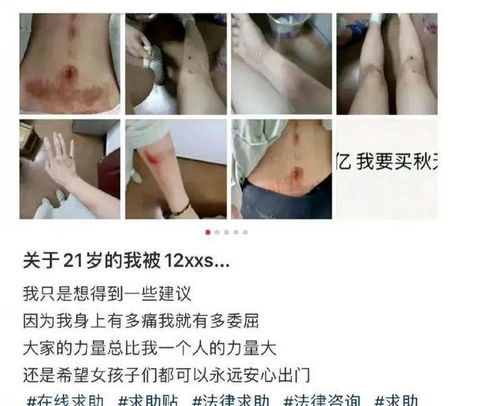 12岁女孩以为月经不调竟是癌症晚期_12岁女孩以为月经不调竟是癌症晚期 母亲一夜白头：再难都不想放弃